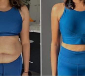 Medical Weight Loss + Peptide Therapy