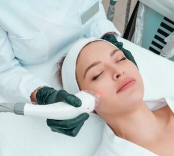IPL PhotoFacials
