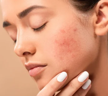 Oncology, Auto‑Immune & Sensitive -Skin Support Facial