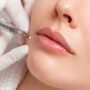 Hyaluronic Fillers (Restylane, Radiesse)