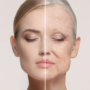 Anti-Aging Firming Facial