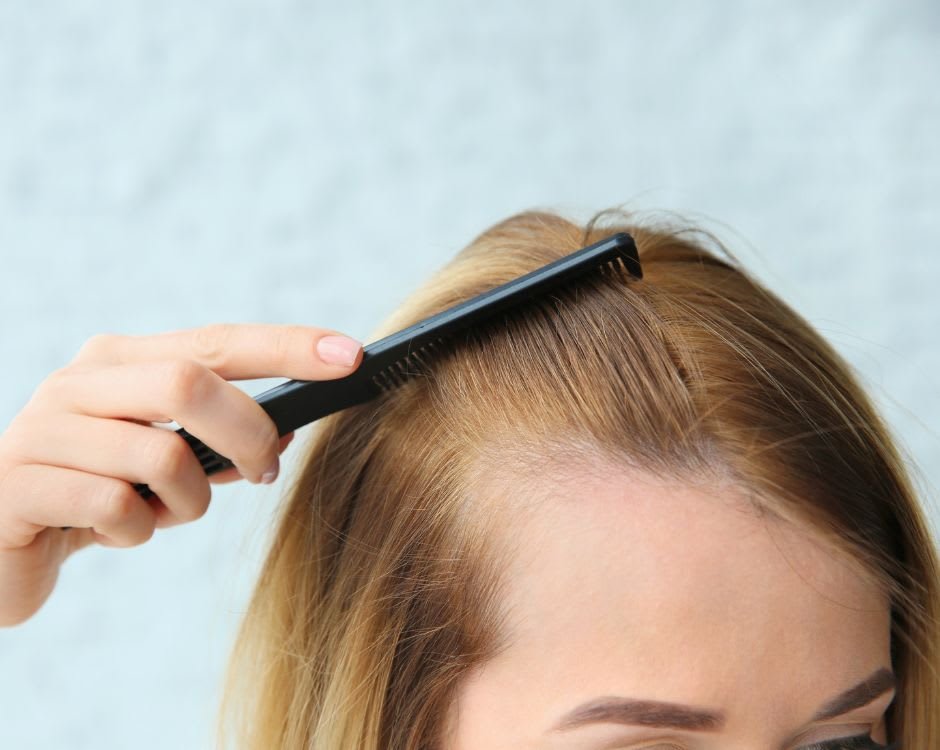 Understanding Different Hair Loss Treatment Options